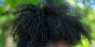 6 Tips For Getting Rid Of Skin Blemishes for Women of Color skin Blemishes